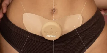 Myoovi – A Drug-Free Solution for Menstrual Pain Relief